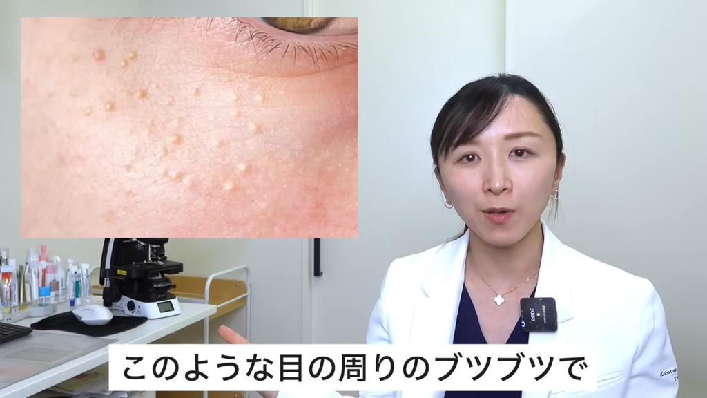 目の周りのブツブツ　症例写真