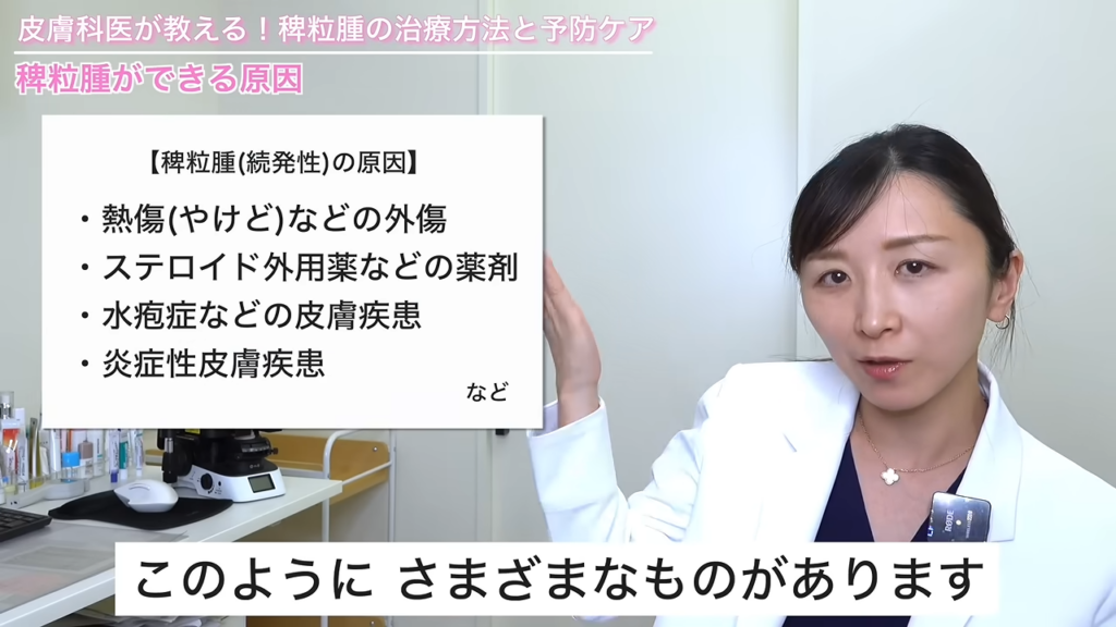 稗粒腫ができる原因：熱傷（やけど）などの外傷、ステロイド外用薬などの薬剤、水疱症などの皮膚疾患、炎症性皮膚疾患など