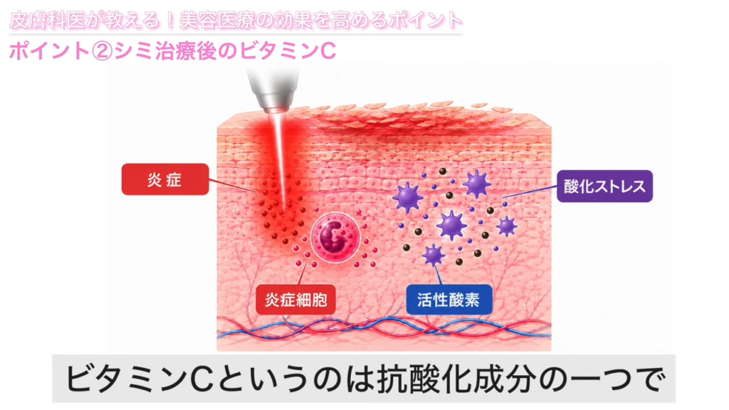 ビタミンCの働き　解説図