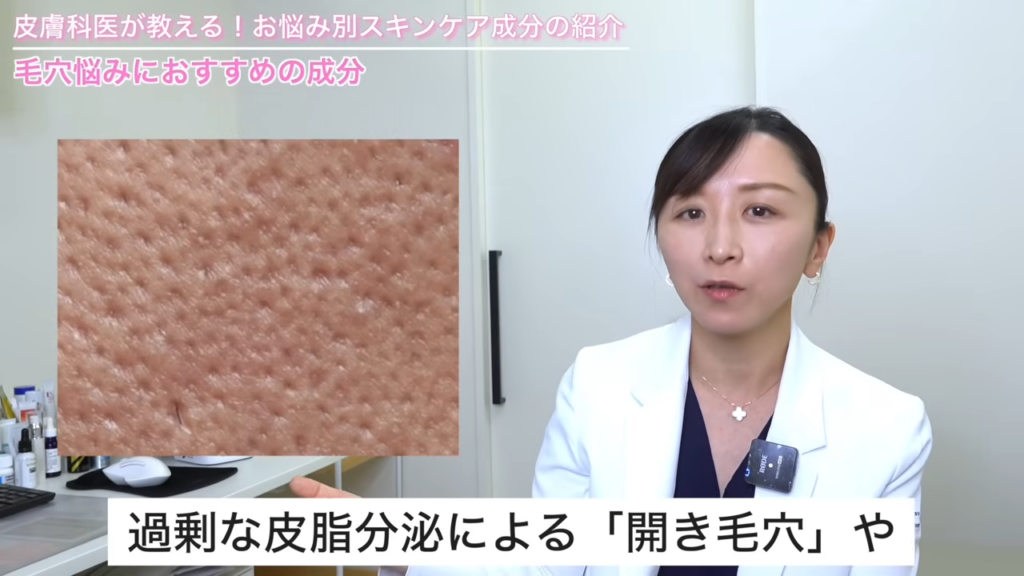 過剰な皮脂分泌による「開き毛穴」症例写真