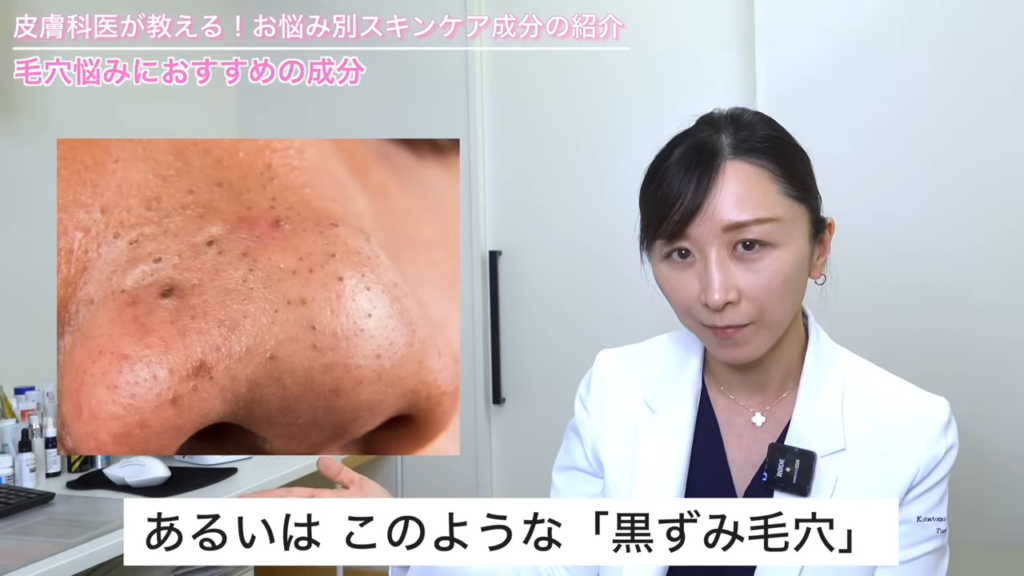 黒ずみ毛穴の症例写真