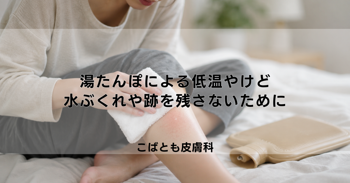 湯たんぽによる「低温やけど」の正しい処置|水ぶくれや跡を残さないために