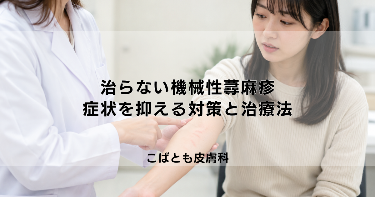 治らない機械性蕁麻疹、どう付き合う?症状を抑えるための対策と治療法