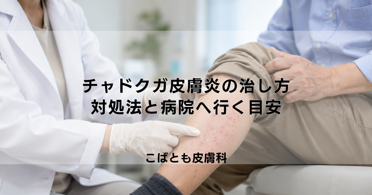 【緊急】チャドクガ皮膚炎の正しい治し方|やってはいけない対処法と病院へ行く目安