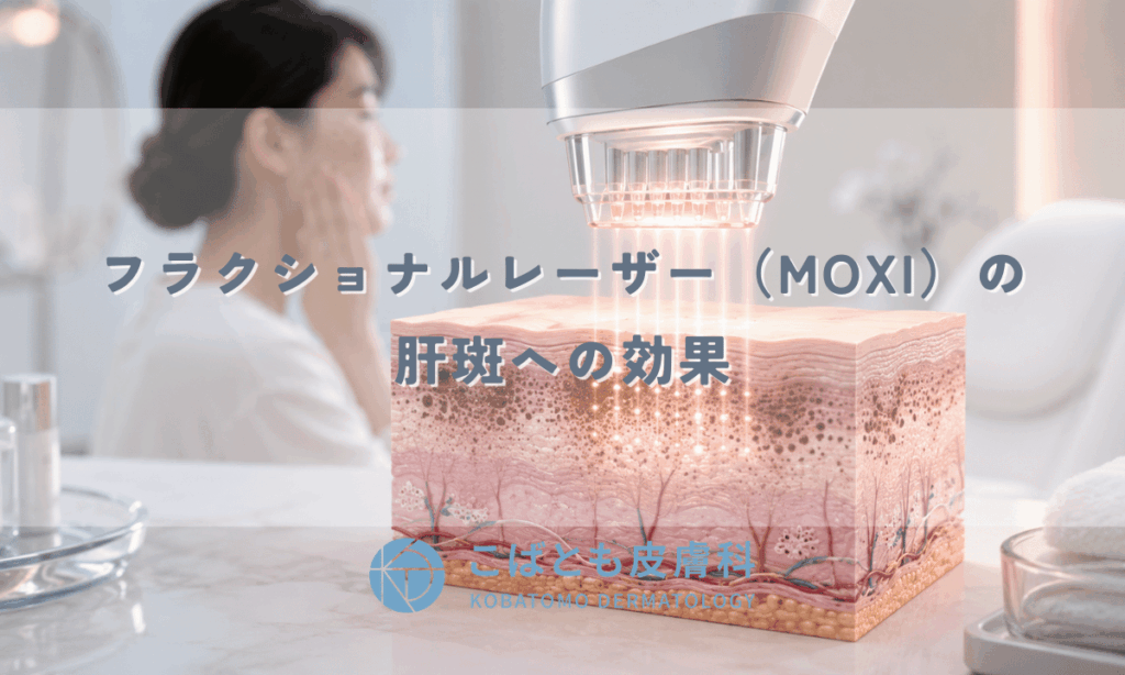 フラクショナルレーザー（MOXI）の肝斑への効果 — 非蒸散型レーザーが有効な理由を皮膚科医が解説