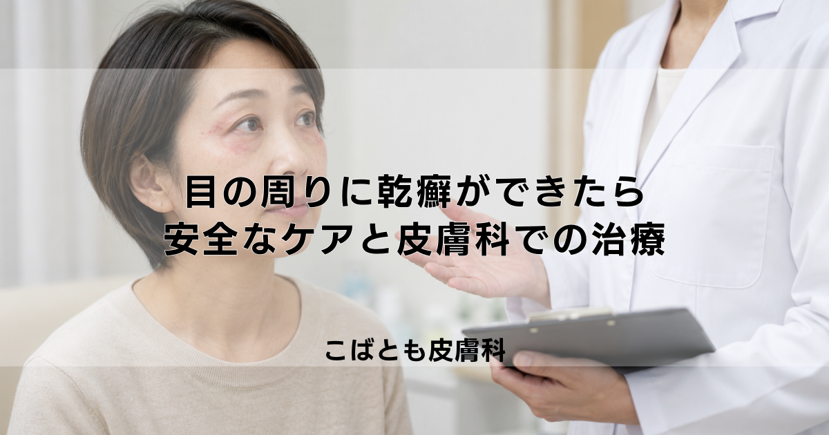 【要注意】目の周りに乾癬ができた時の対処法|安全なケアと皮膚科での治療