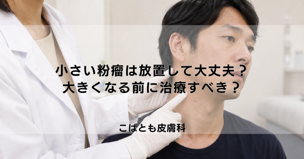 小さい粉瘤（ふんりゅう）は放置しても大丈夫？大きくなる前に治療すべき？