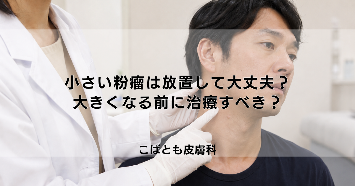 小さい粉瘤（ふんりゅう）は放置しても大丈夫？大きくなる前に治療すべき？