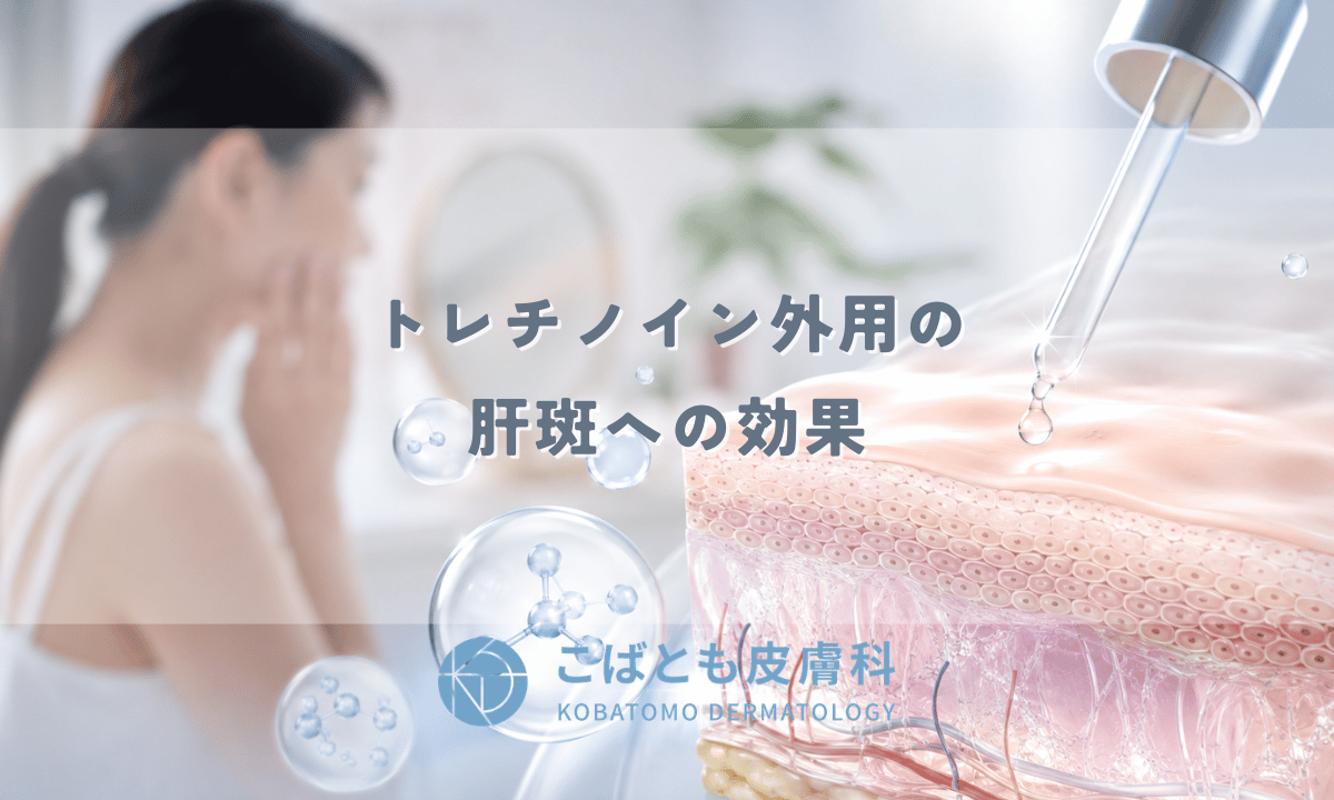 トレチノイン外用の肝斑への効果 — ハイドロキノン併用療法の使い方と注意点