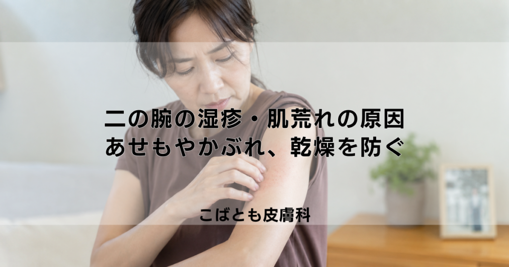 二の腕の湿疹・肌荒れの原因は？あせもやかぶれ、乾燥を防ぐためのケア方法