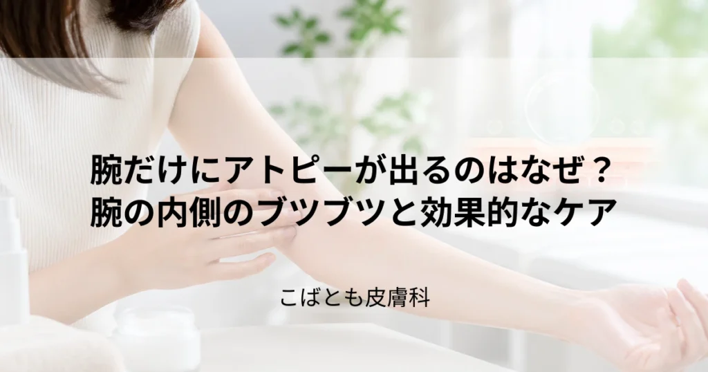 なぜ腕だけにアトピーが？腕の内側のブツブツの原因と効果的なケア