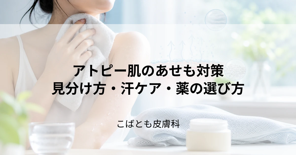 アトピー肌のあせも対策｜見分け方と悪化させない汗ケア・薬の選び方