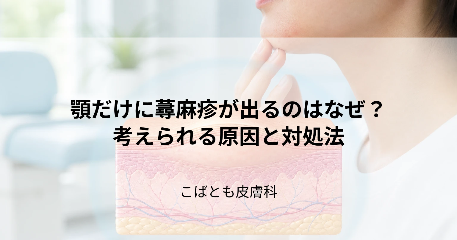顎だけに蕁麻疹（じんましん）が出るのはなぜ？考えられる原因と対処法