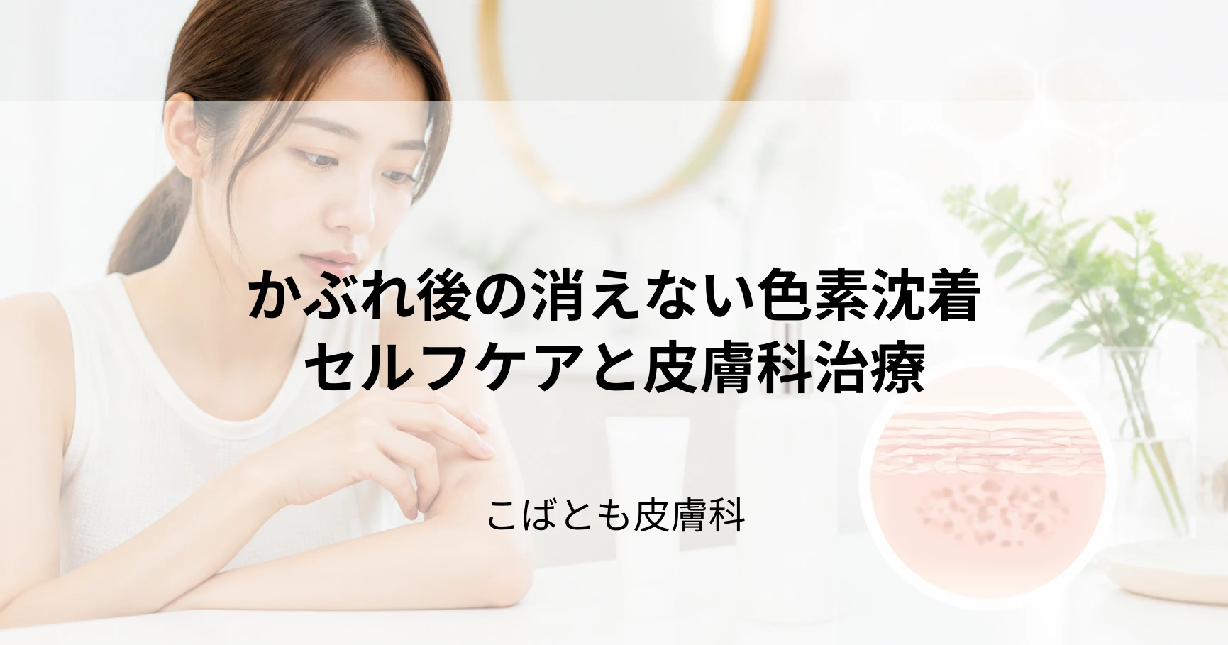 かぶれが治った後の消えない跡（色素沈着）を薄くする方法｜セルフケアと皮膚科治療