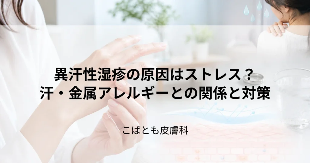 異汗性湿疹が悪化する原因はストレス？汗や金属アレルギーとの関係と対策