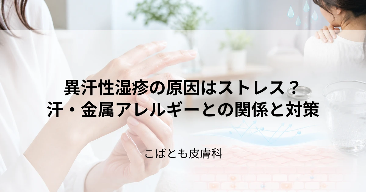 異汗性湿疹が悪化する原因はストレス？汗や金属アレルギーとの関係と対策