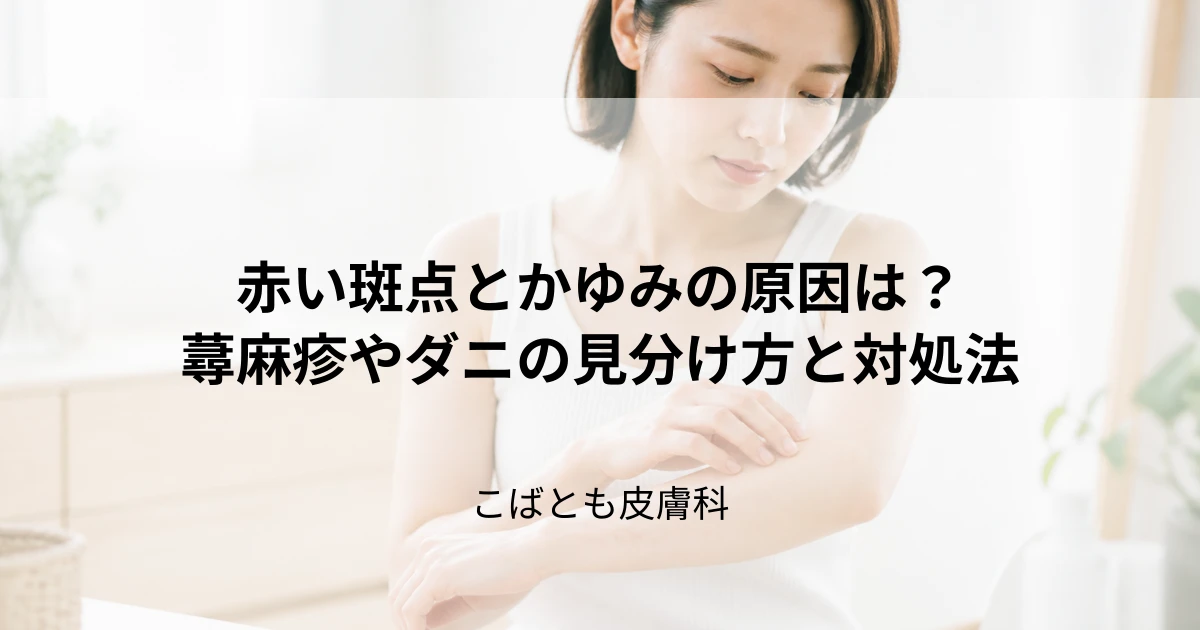 体にできた赤い斑点とかゆみの原因は？蕁麻疹やダニなどの見分け方と対処法