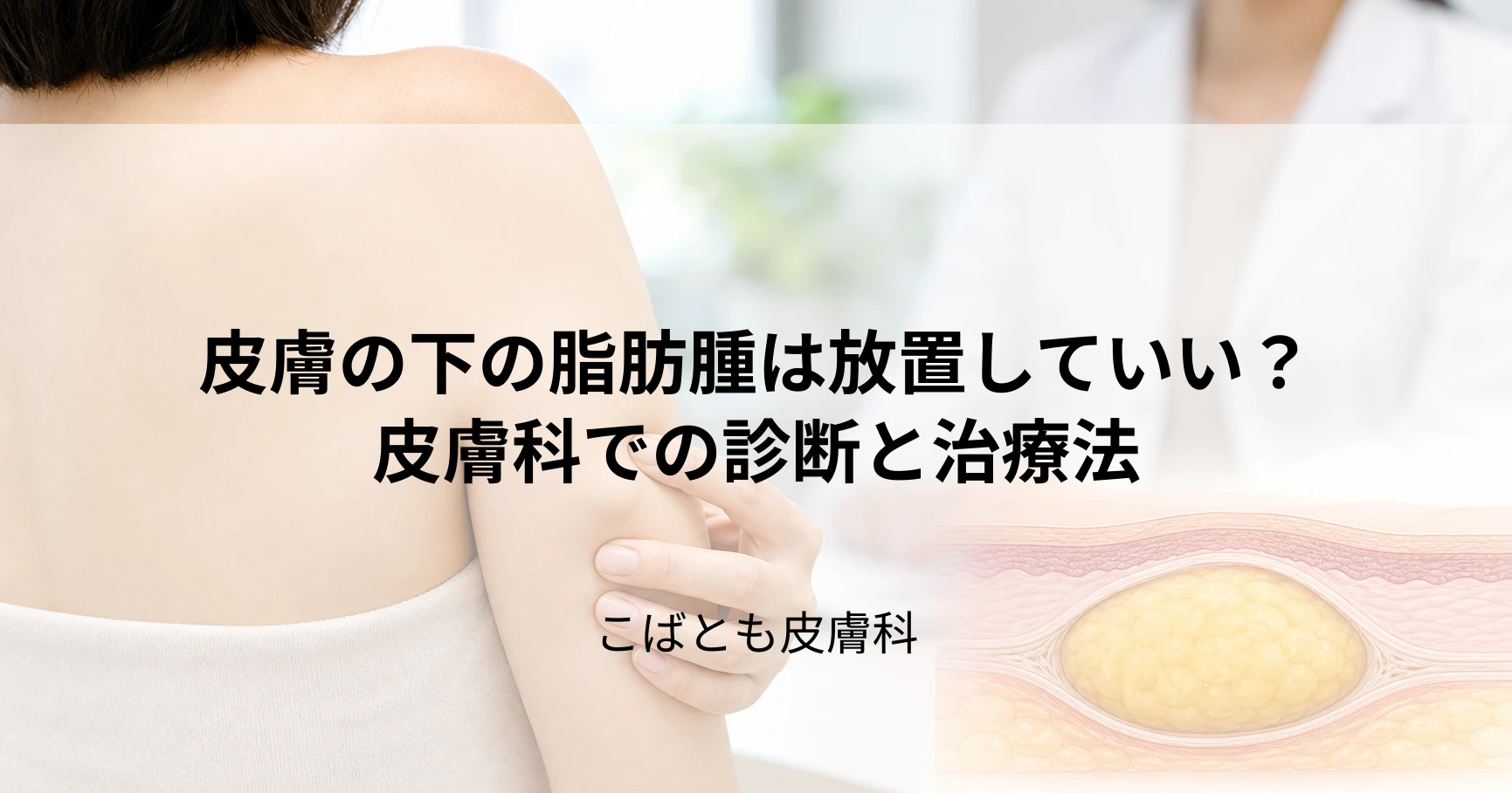 皮膚の下の柔らかい「脂肪腫」は放置していい？皮膚科での診断と治療法