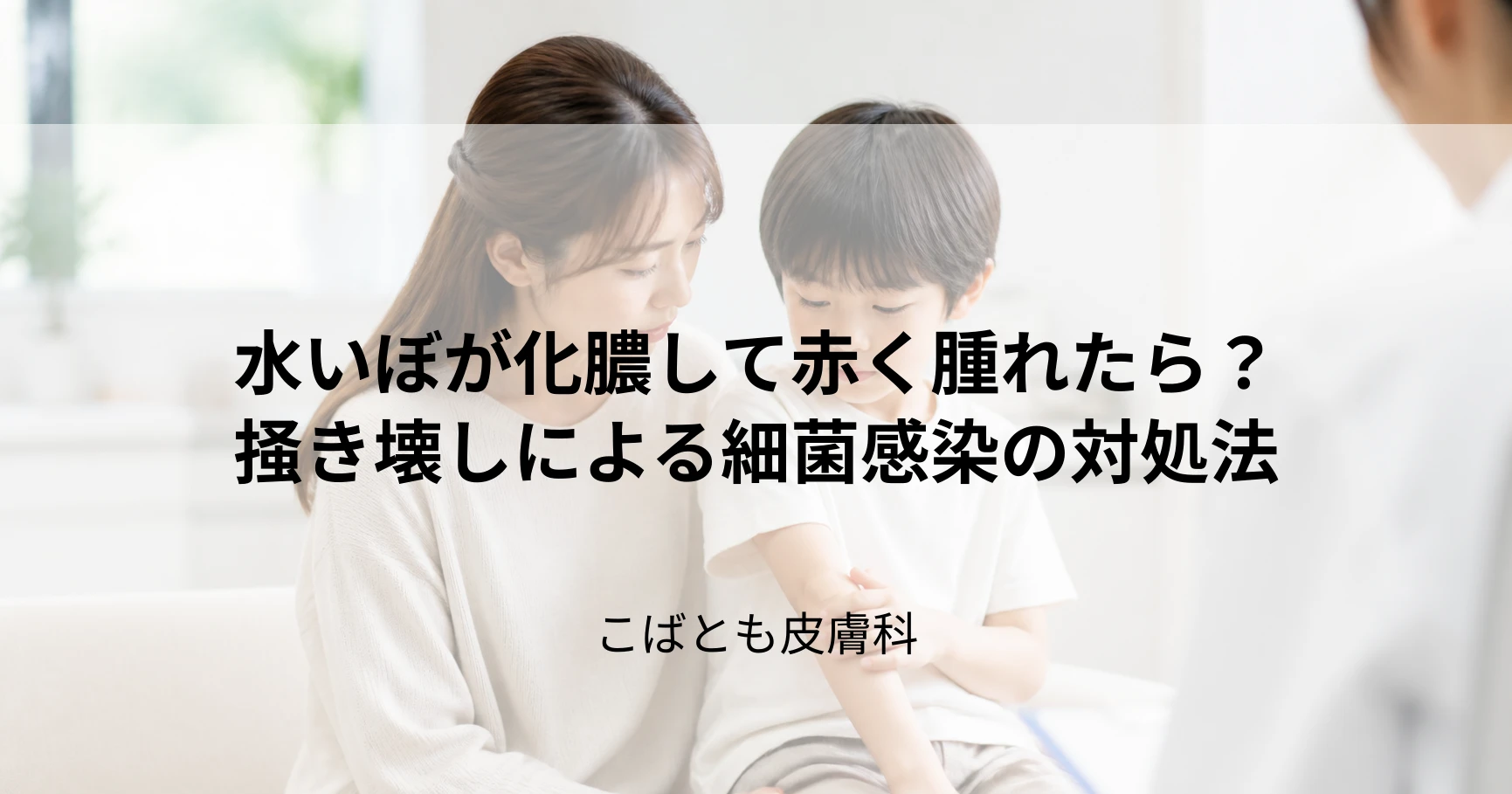 水いぼが化膿して赤く腫れたらどうする？掻き壊しによる細菌感染の対処法