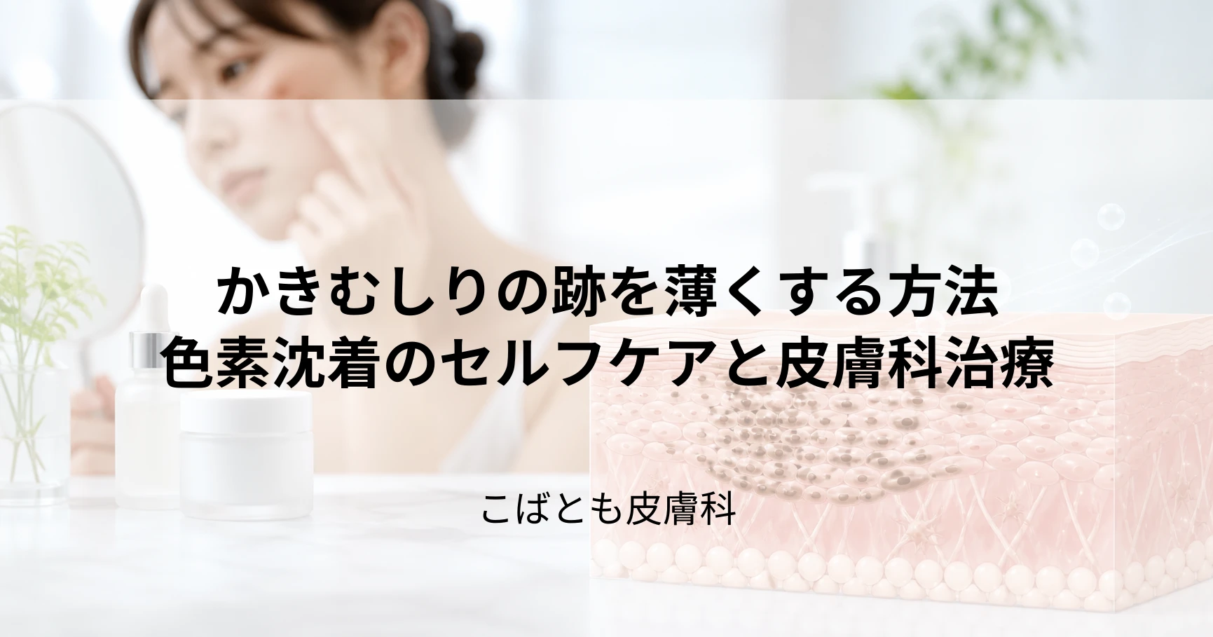 かきむしりによるかゆみの跡…色素沈着を自力で薄くする方法と皮膚科での治療