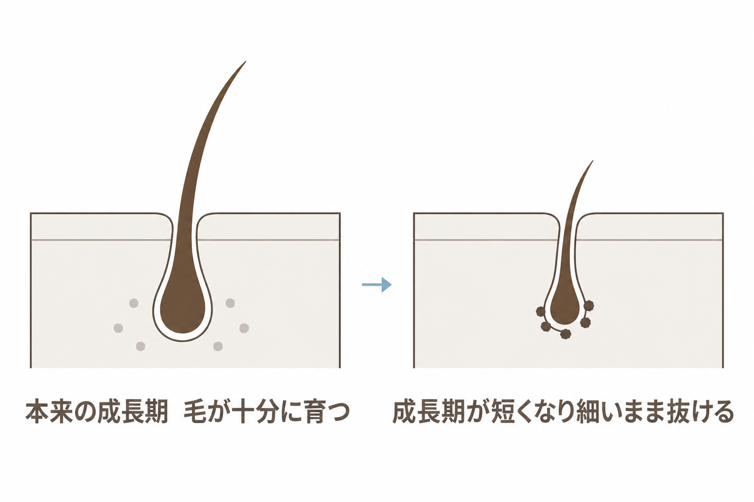 成長期が短くなり、毛が十分に育たないまま抜ける