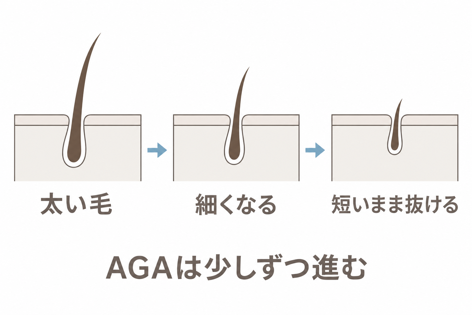 太い毛が細くなり、短いまま抜けるようになる