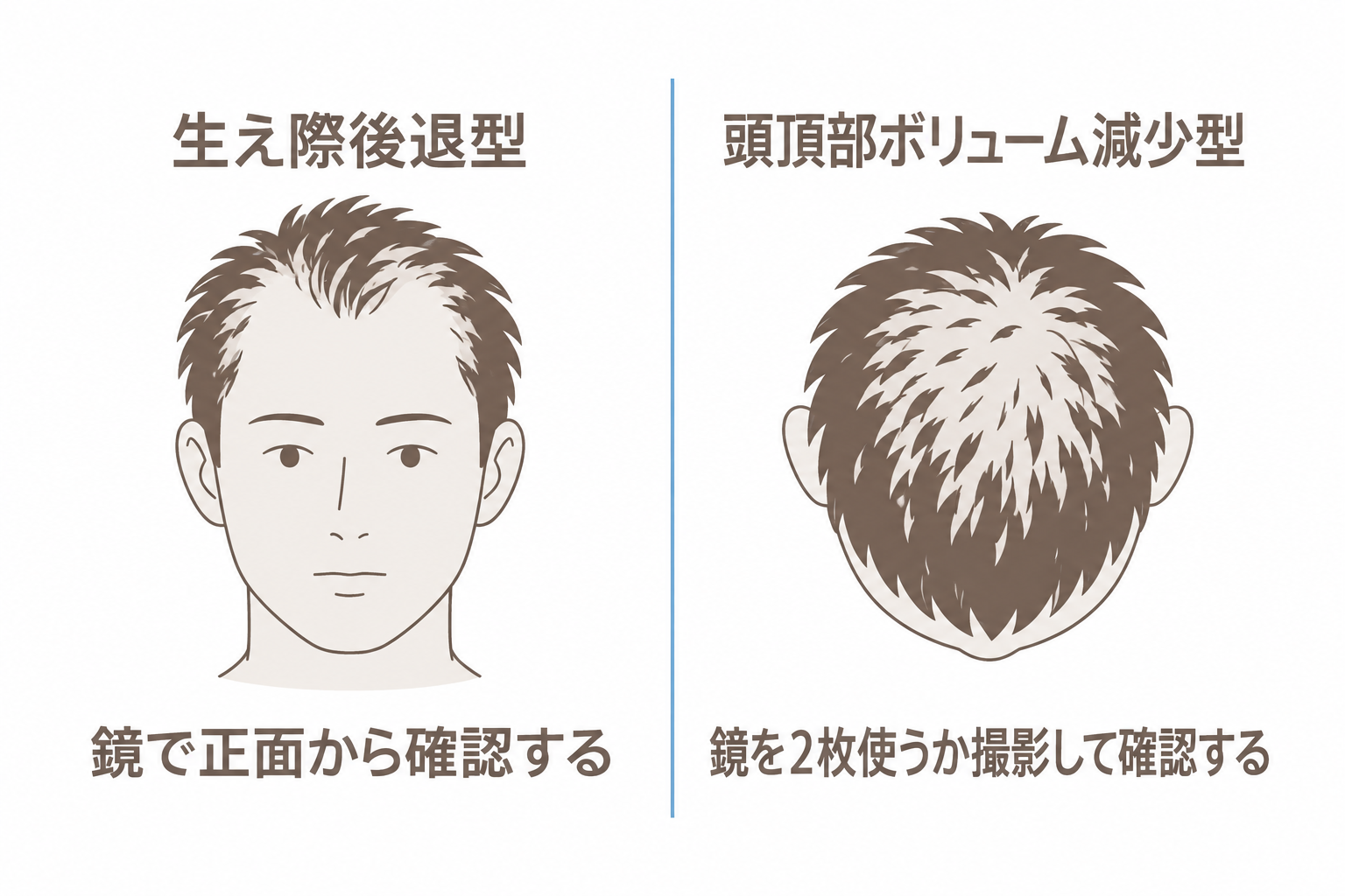 セルフチェック。生え際は鏡で正面から、頭頂部は鏡を2枚使うか撮影して確認する
