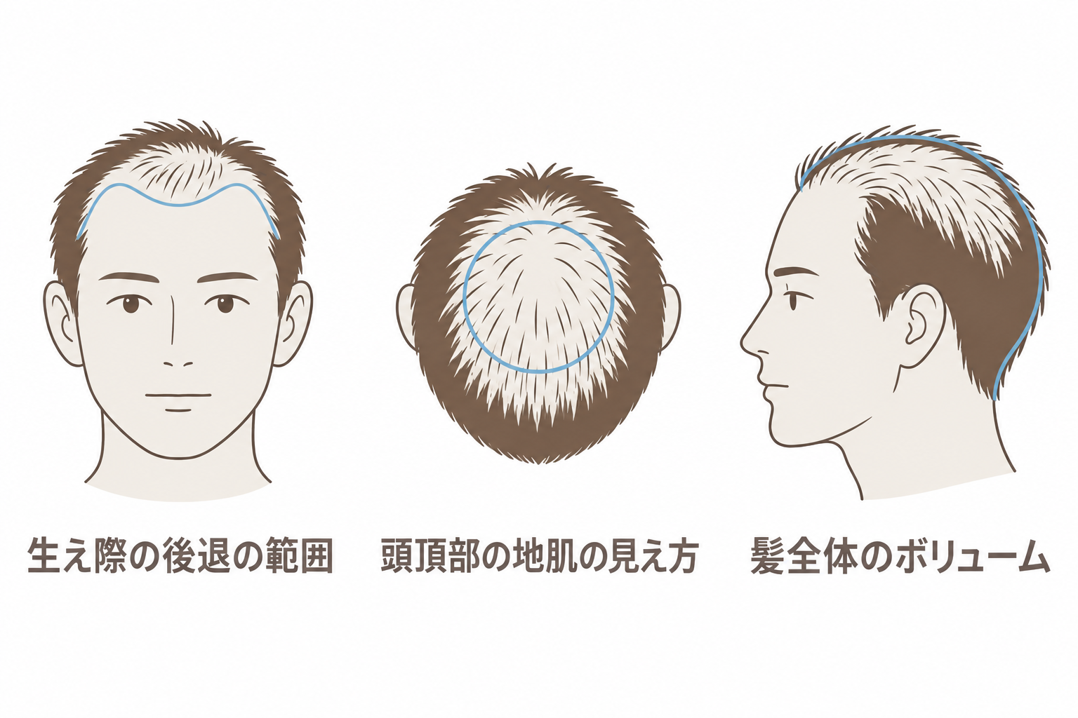 進行度合いを判断するために医師が見る3つの点