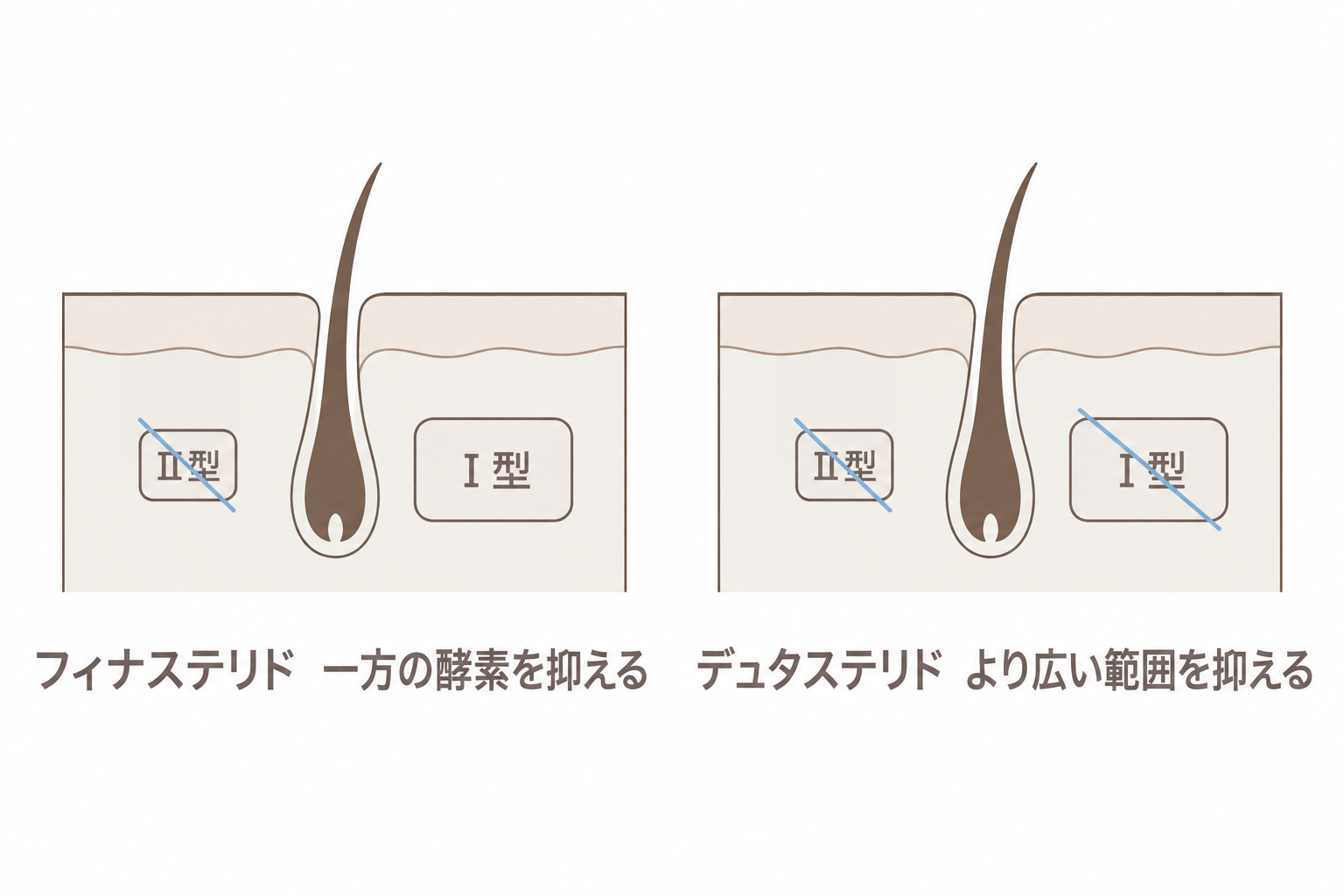 フィナステリドは一方の酵素、デュタステリドはより広い範囲を抑える