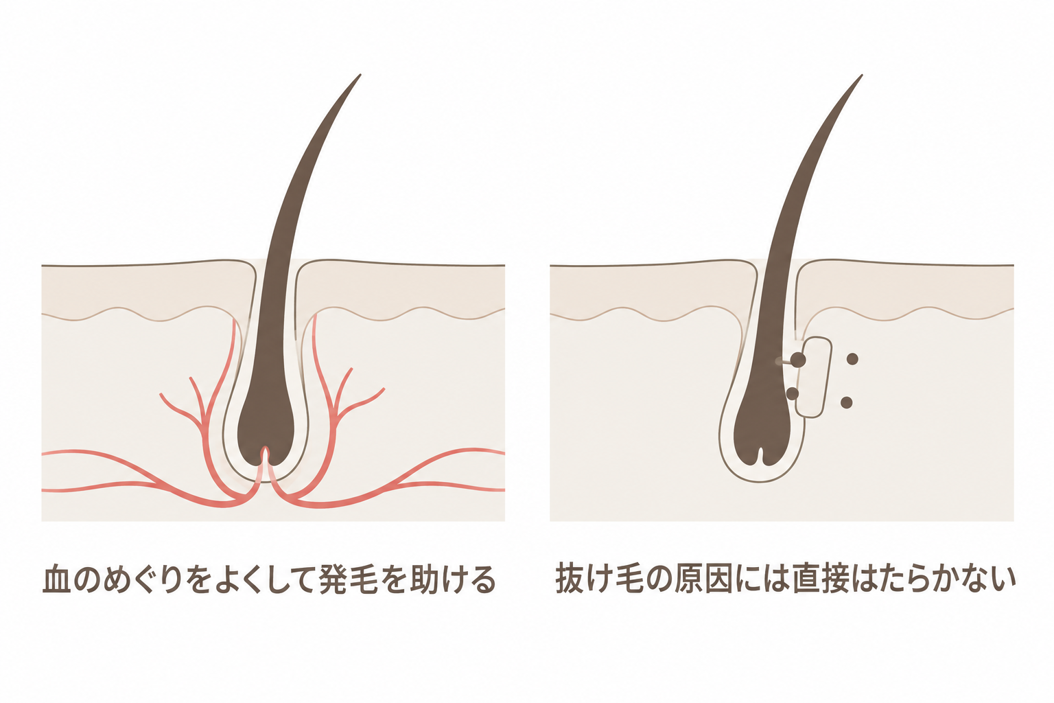 ミノキシジル外用薬は血のめぐりをよくするが、抜け毛の原因には直接はたらかない
