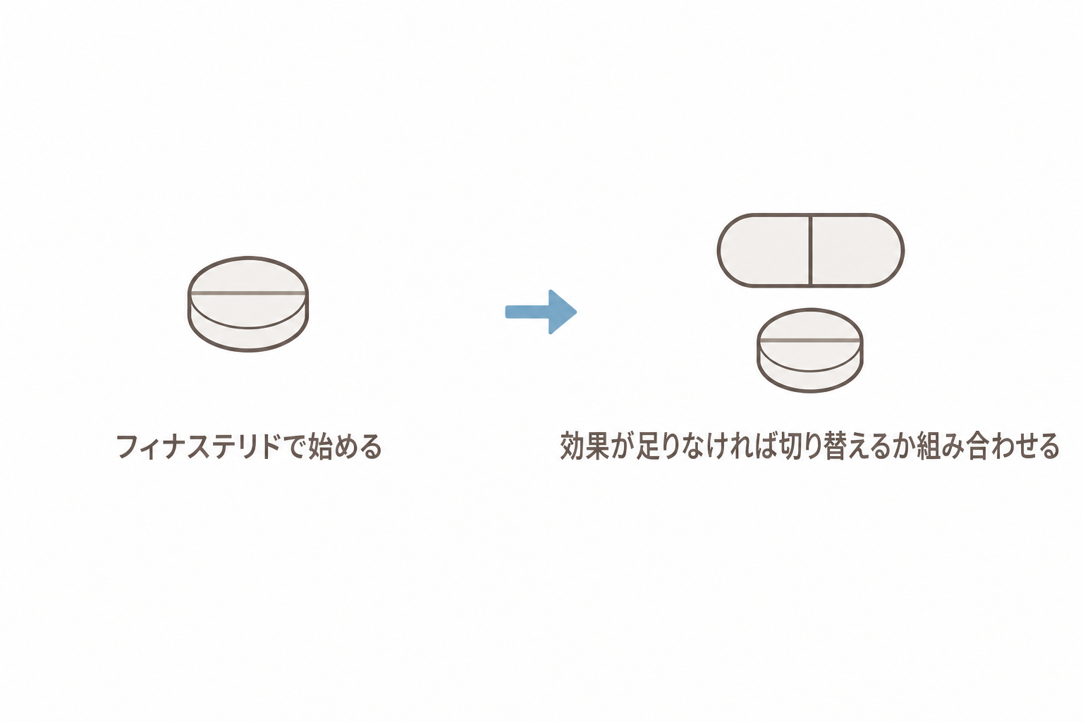 フィナステリドで始め、効果が足りなければ切り替えるか組み合わせる