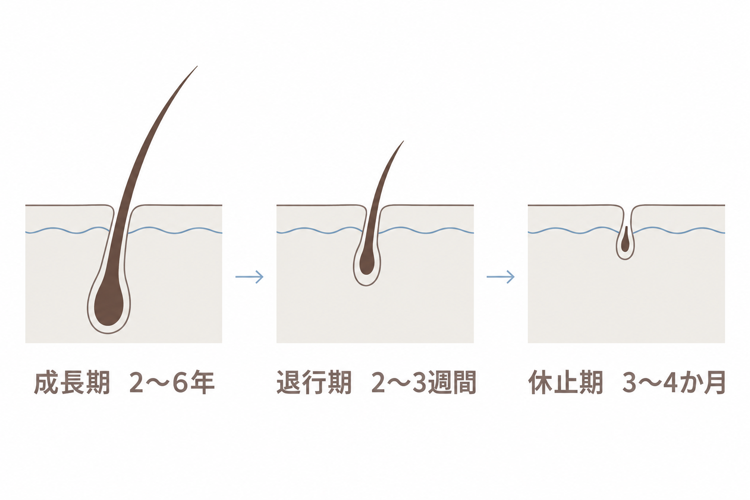 ヘアサイクルの3段階。成長期2〜6年、退行期2〜3週間、休止期3〜4か月
