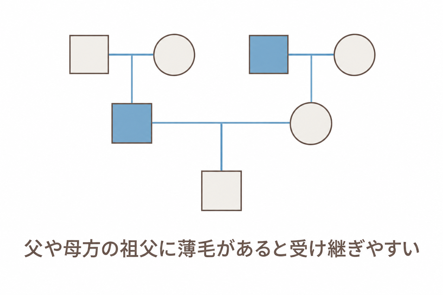 父や母方の祖父に薄毛があると受け継ぎやすい