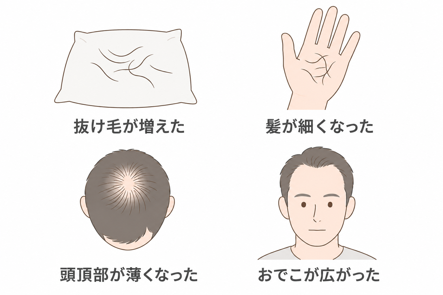 AGAの初期に気づきやすい4つの変化