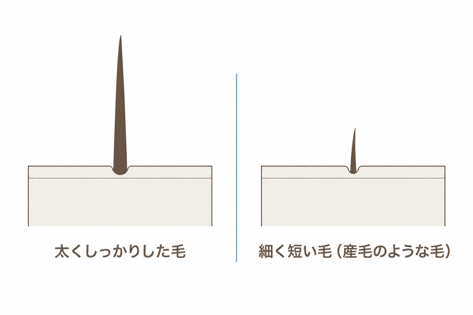 太くしっかりした毛と、細く短い産毛のような毛のちがい