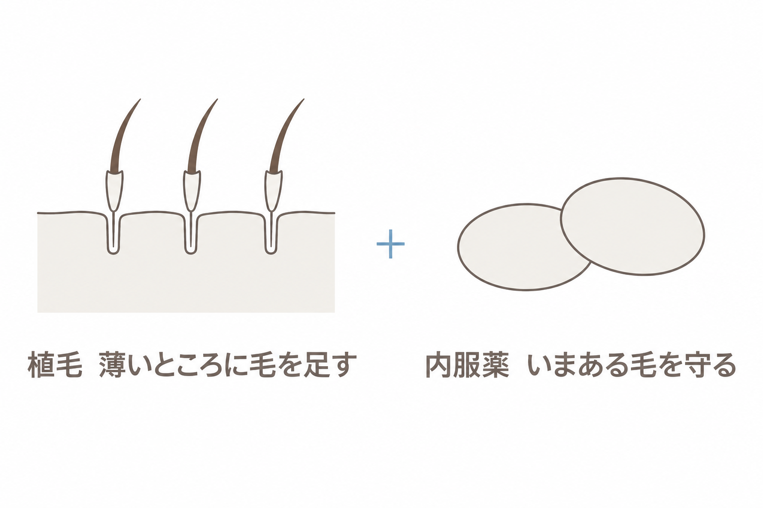 植毛と内服薬の併用