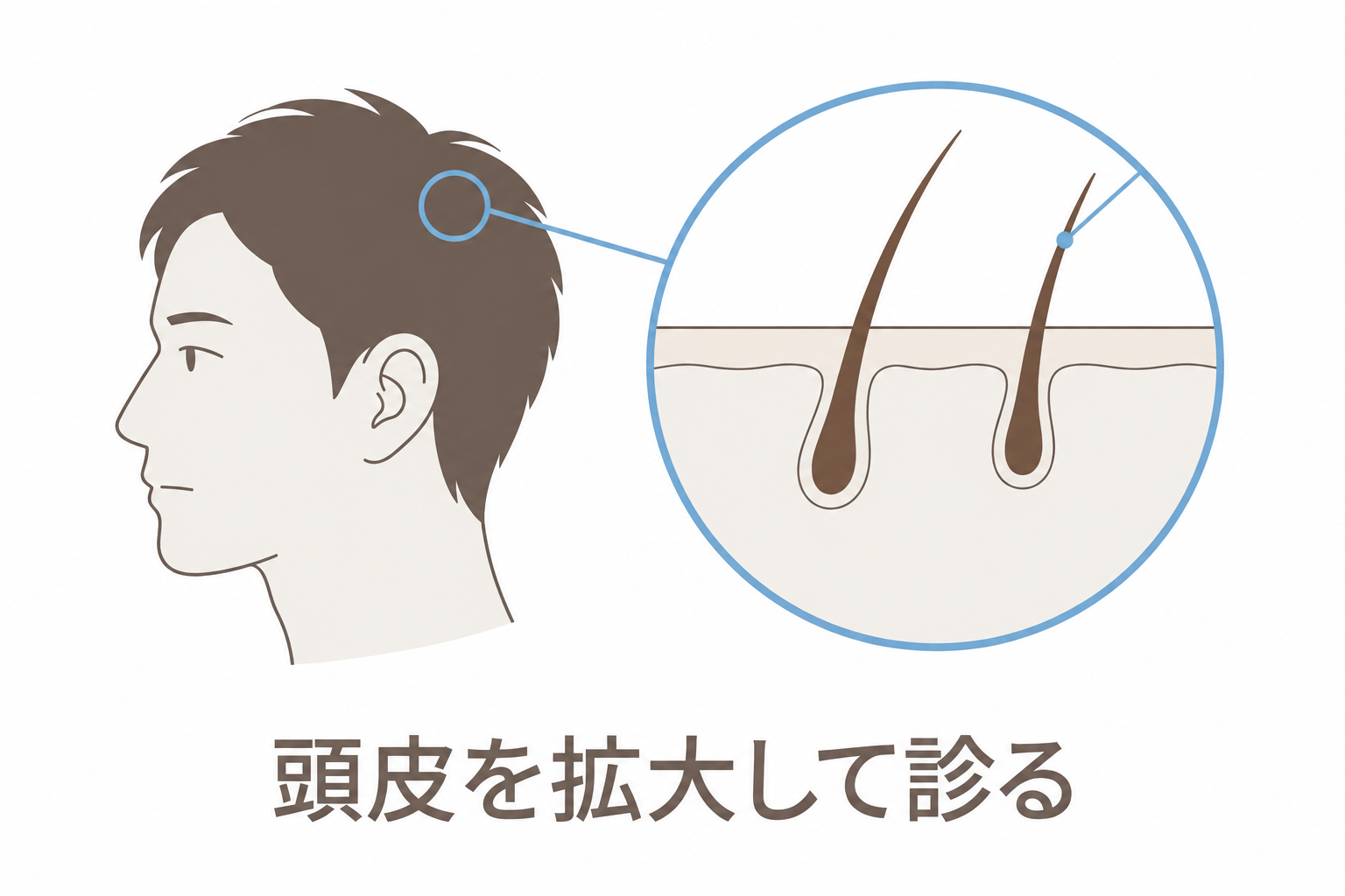 頭皮を拡大して診る
