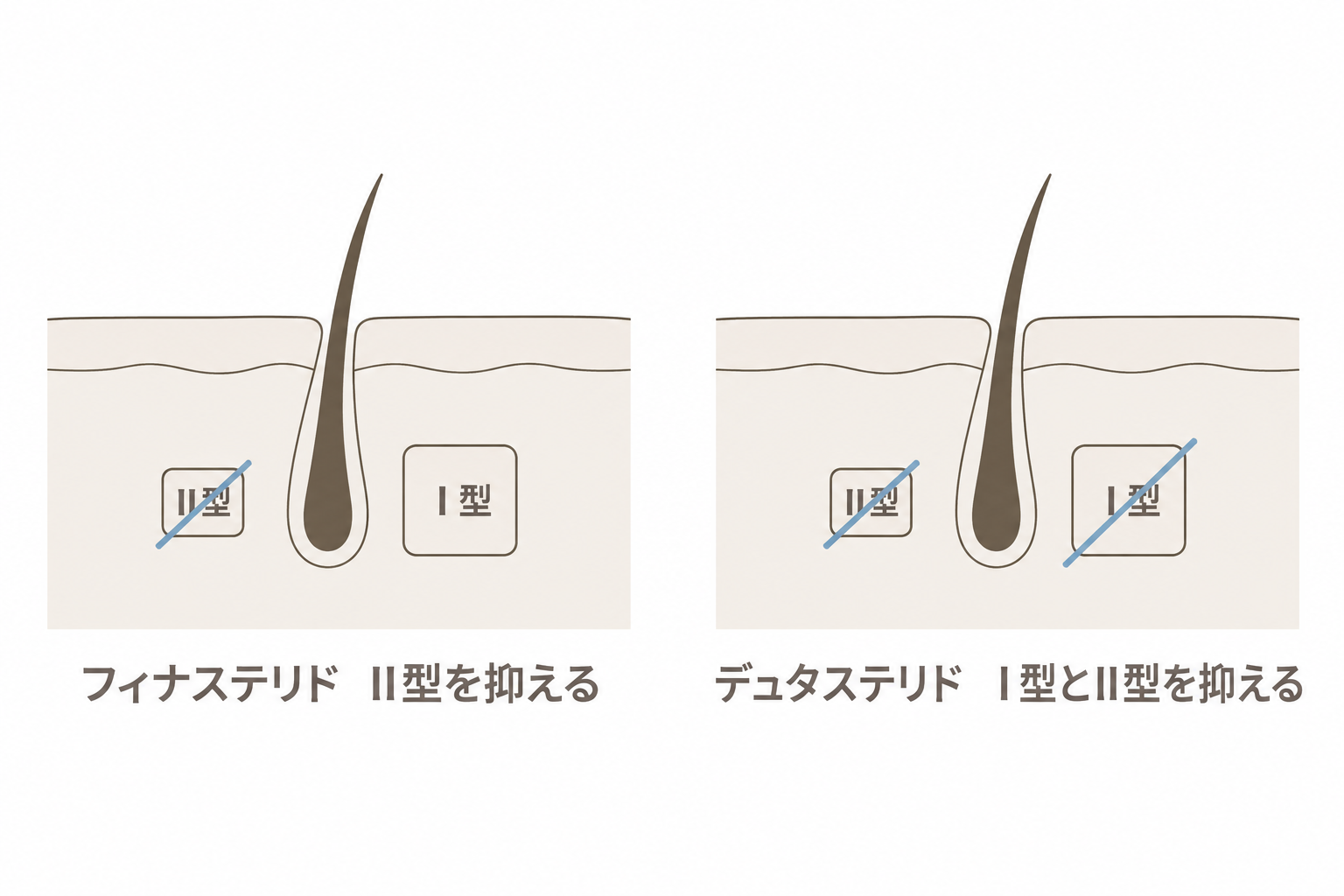 フィナステリドはⅡ型、デュタステリドはⅠ型とⅡ型を抑える
