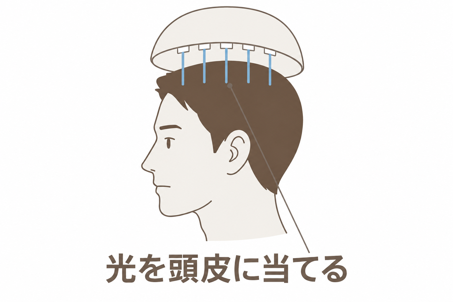 頭皮に光を当てる機器