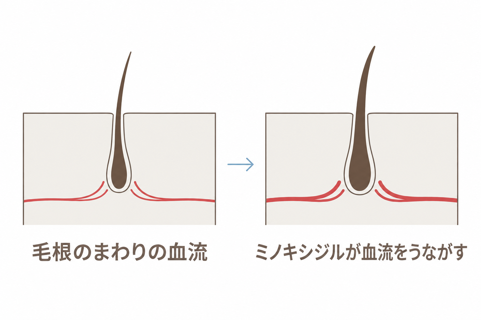 ミノキシジルが毛根のまわりの血流をうながす
