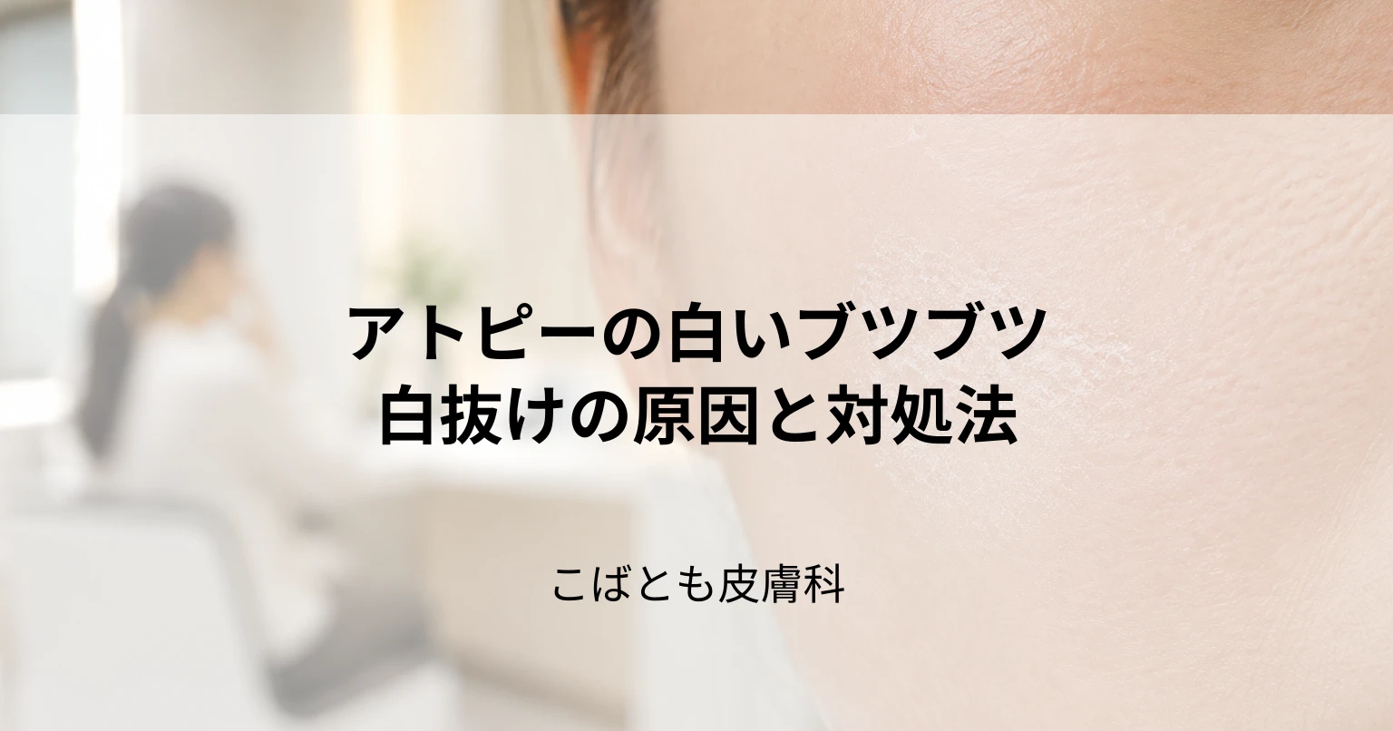 アトピーで肌に白いブツブツや白抜けが…その原因と対処法を解説