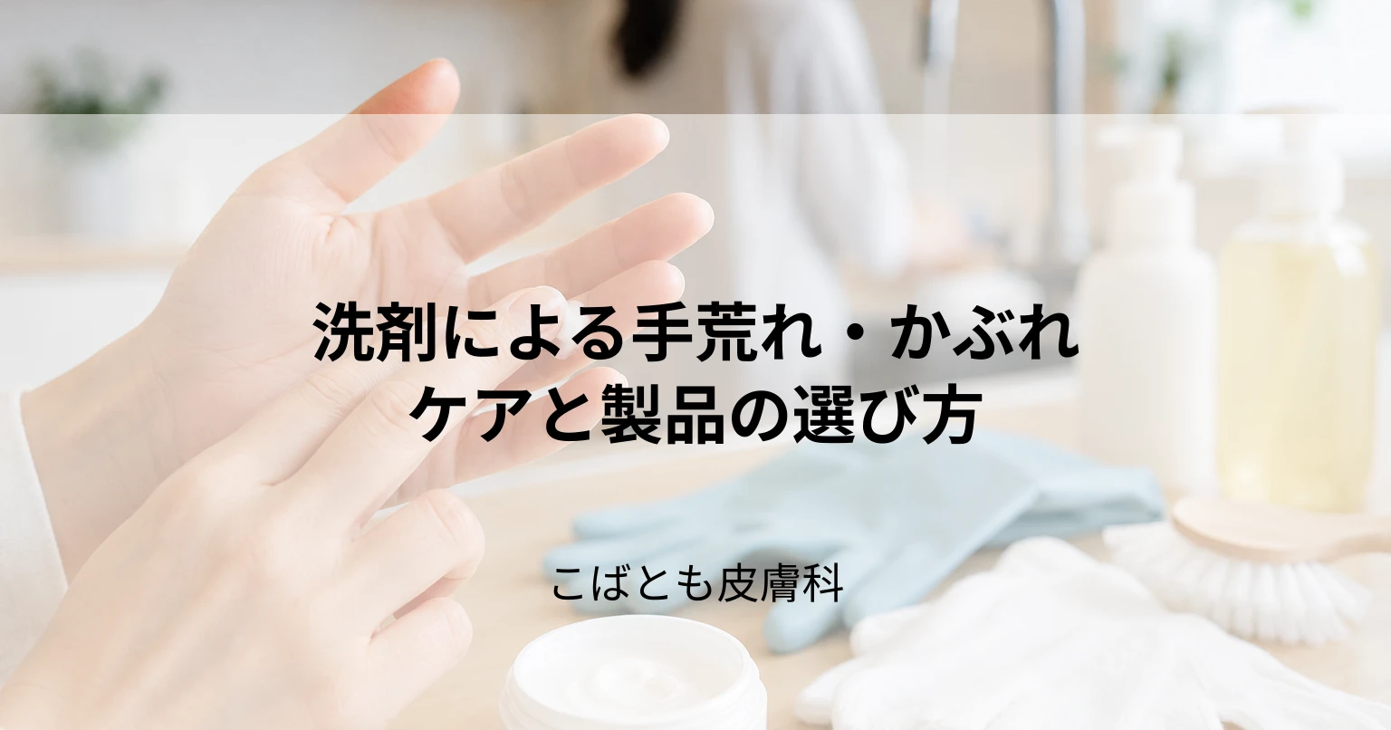 洗剤による手荒れ・かぶれの治し方|原因となる成分と肌に優しい製品の選び方