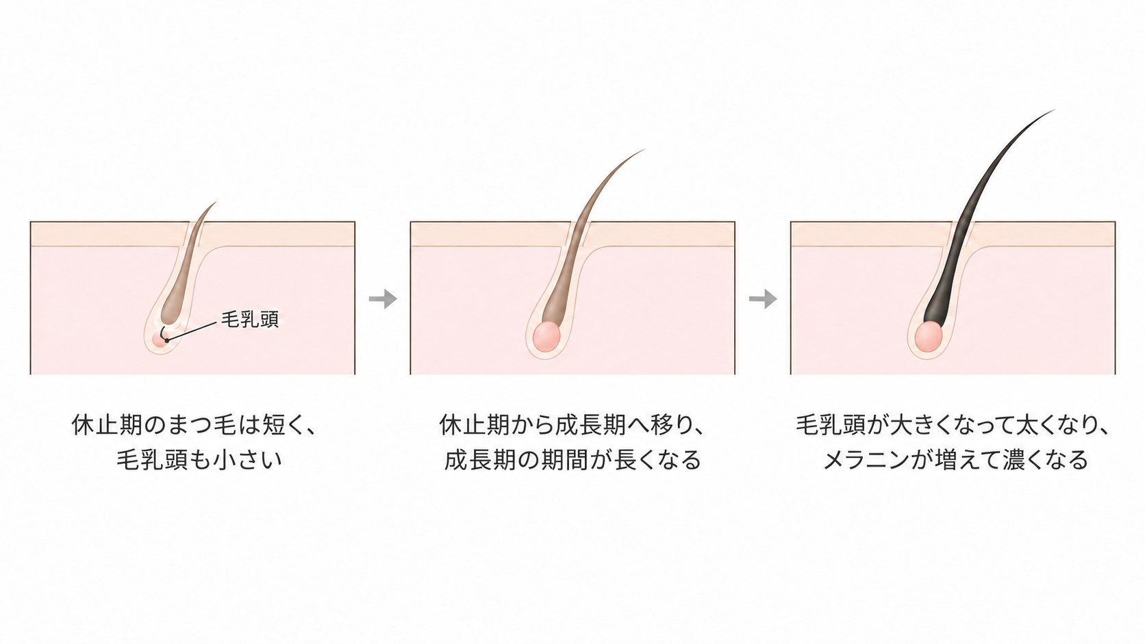 まつ毛の毛周期の図。休止期から成長期へ移り、毛乳頭が大きくなってまつ毛が長く太く濃くなる
