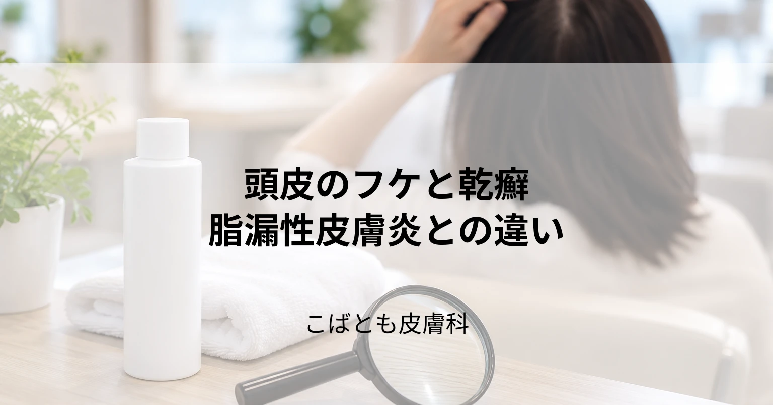 頭皮のフケが「乾癬(かんせん)」か見分ける方法|脂漏性皮膚炎との違いと治療法